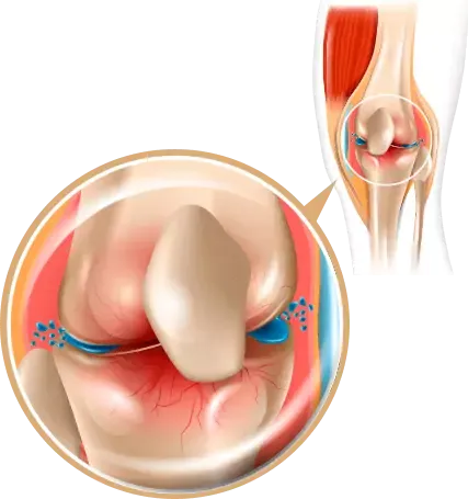 Ilustrasi fleksibilitas sendi dan mobilitas